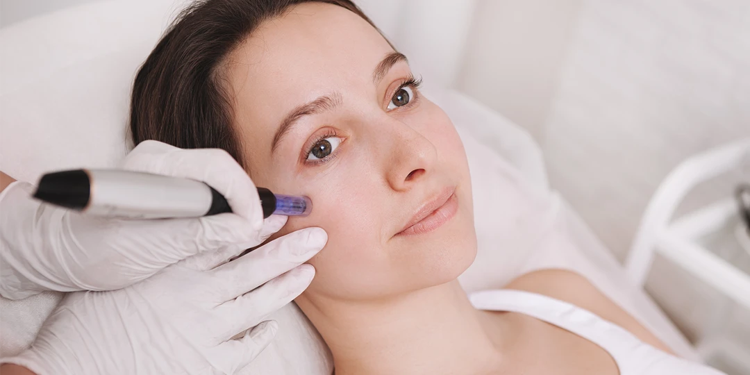 Qué es el dermapen