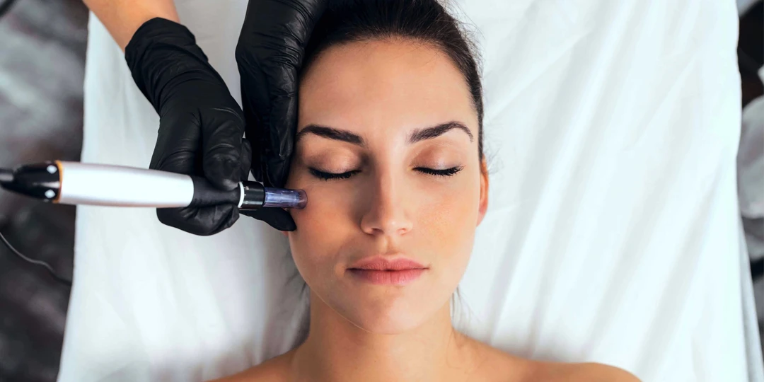 Tratamiento dermapen Microneedling para tu rostro